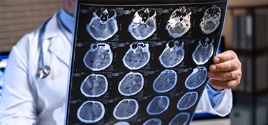 Male physican holding x-ray film of brain screeings.